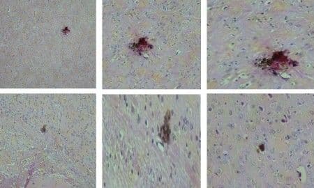 Vacina produzida pela USP contra o vírus zika mostra resultados promissores em testes com camundongos