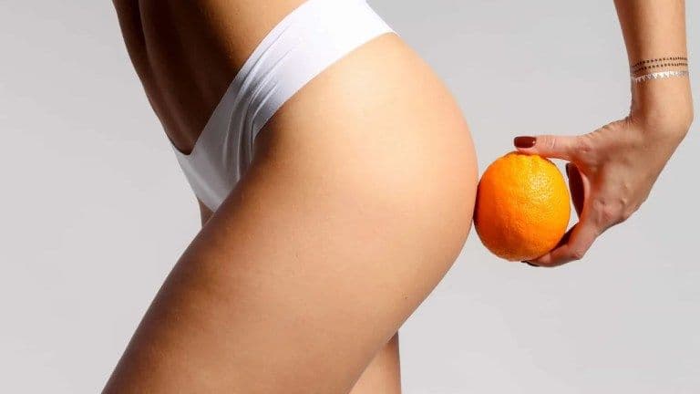 Descubra como Combater a Celulite: Alimentação e Tratamentos