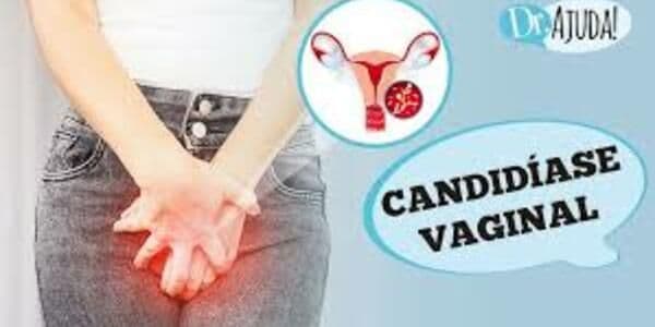 Candidíase Vaginal: o que é, sintomas, diagnóstico, tratamento e prevenção