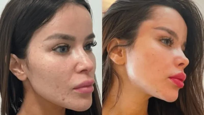 Dentista expõe influencer: 'experiência desagradável'