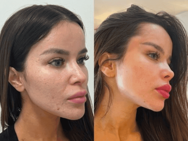 Dentista expõe influencer: 'experiência desagradável'