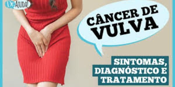 Já ouviu falar de câncer de vulva? Caroço, coceira e feridas podem ser sintomas