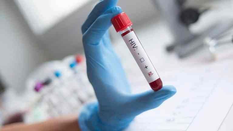 Descubra os Sintomas Iniciais do HIV e Como se Proteger