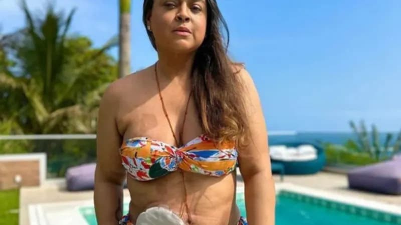 Preta Gil e a Colostomia: Vida Normal Após Cirurgia?